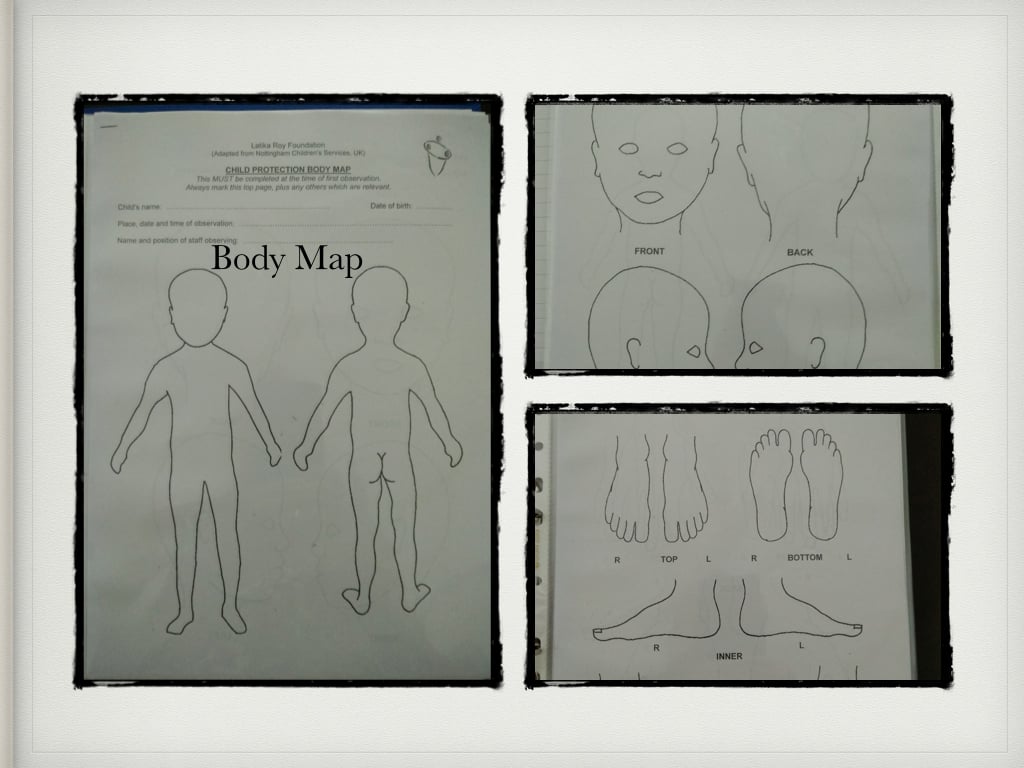 Drawing of an outline of child's body, with details of hands, feet, etc